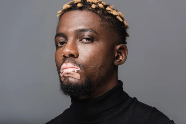 Portrait of african american man with vitiligo skin and stylish hairstyle looking at camera isolated on grey — Stockfoto