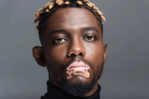 Portrait of african american man with vitiligo skin and trendy hairstyle isolated on grey — Stockfoto