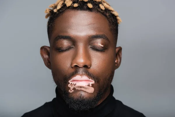 Retrato de joven afroamericano con vitiligo y ojos cerrados aislados sobre gris - foto de stock