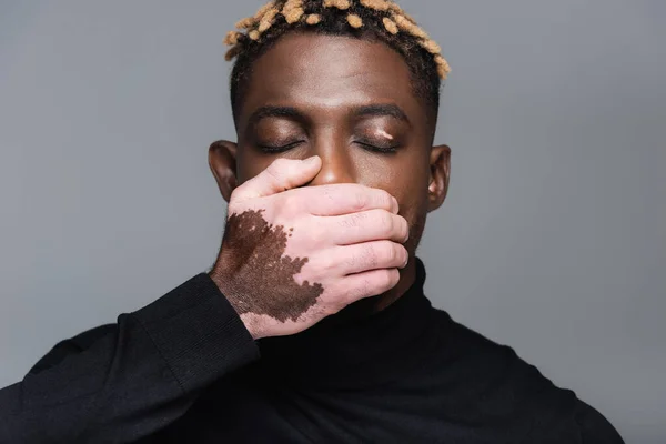 African american man with vitiligo skin and closed eyes covering mouth with hand isolated on grey — стоковое фото