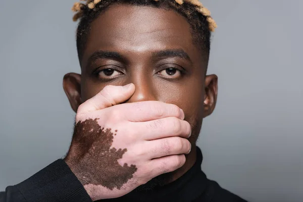 Young african american man with vitiligo covering mouth with hand isolated on grey — Fotografia de Stock