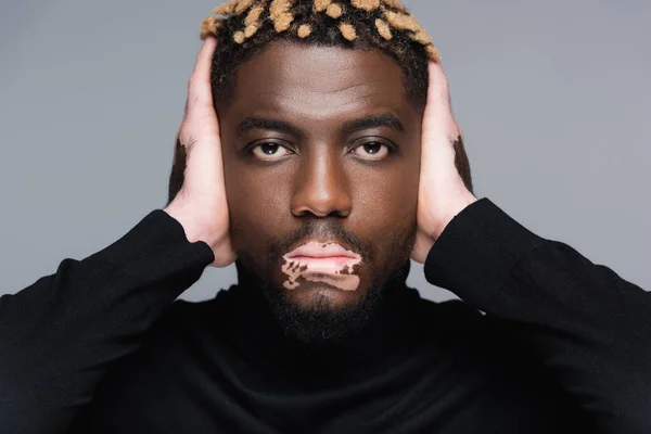 Trendy african american man with vitiligo looking at camera and touching head isolated on grey — Stockfoto