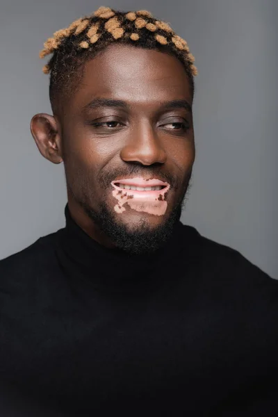 Alegre hombre afroamericano con piel de vitiligo, con cuello alto negro aislado en gris - foto de stock