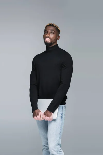 African american man with vitiligo and trendy hairstyle looking at camera while posing isolated on grey — Stockfoto
