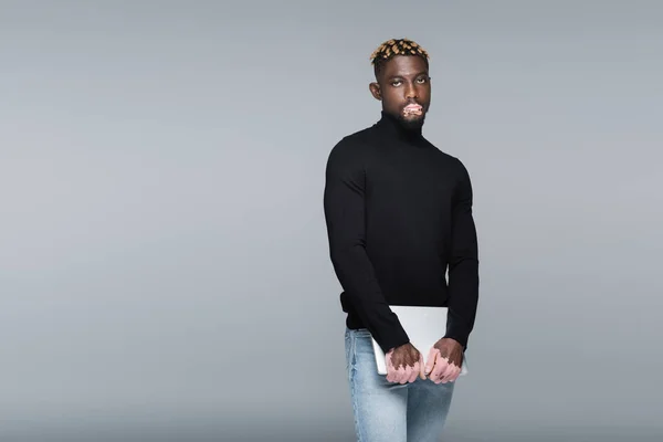 Trendy african american man with vitiligo, in black turtleneck and jeans, posing with laptop isolated on grey — Fotografia de Stock