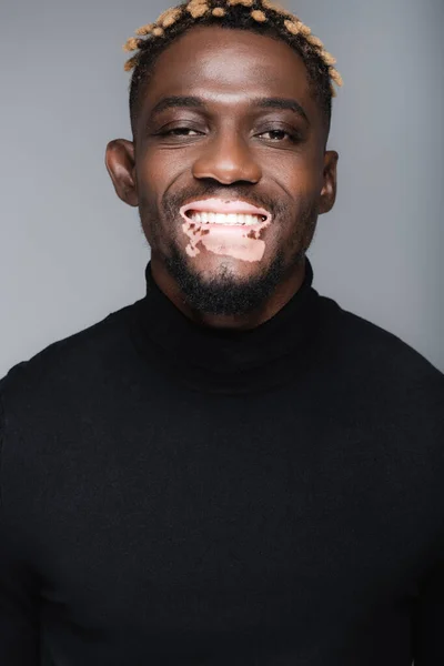 Cheerful african american man with vitiligo and trendy hairstyle looking at camera isolated on grey — Stockfoto