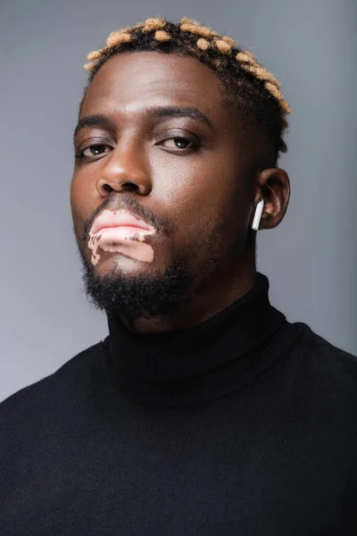 Portrait of african american man with vitiligo listening music in earphone and looking at camera isolated on grey — Stock Photo