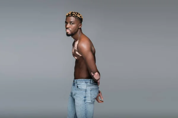 Без сорочки афроамериканський чоловік з вітіліго дивиться на камеру, позує в джинсах ізольовано на сірому — стокове фото