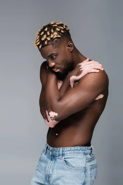 Shirtless african american man with vitiligo skin covering chest with hands while standing isolated on grey — стоковое фото