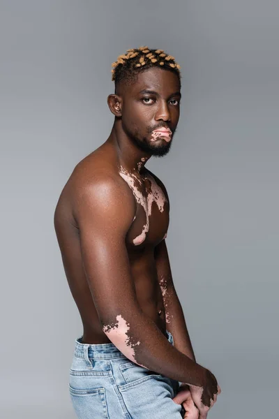 Shirtless african american man with vitiligo skin and trendy hairstyle looking at camera isolated on grey — Stockfoto