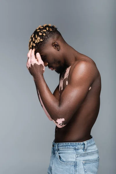 Vista lateral del hombre afroamericano sin camisa con vitiligo tocando la frente aislado en gris - foto de stock