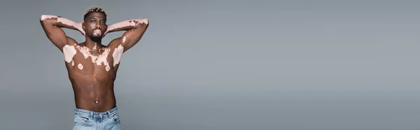 Shirtless and muscular african american man with vitiligo skin standing with hands behind head isolated on grey, banner — Foto stock