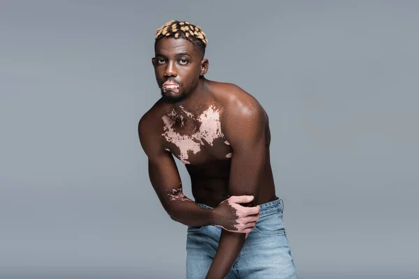 Shirtless african american man with vitiligo skin and trendy hairstyle posing isolated on grey — Stockfoto