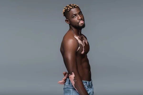 Shirtless african american man with vitiligo looking at camera while posing in jeans isolated on grey — Stockfoto