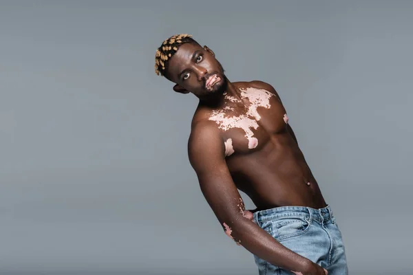 Young and shirtless african american man with vitiligo skin and trendy hairstyle posing isolated on grey — стоковое фото