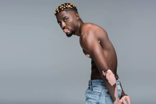 Young and shirtless african american man with vitiligo posing with hands behind back isolated on grey — Stock Photo