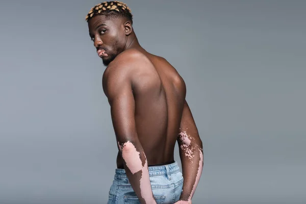 Афроамериканський чоловік зі шкірою вітіліго позує без сорочки ізольовано на сірому — стокове фото