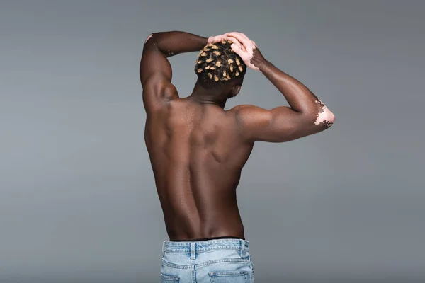 Вид ззаду без сорочки афроамериканця з вітіліго шкіри позує руками на голові ізольовано на сірому — стокове фото