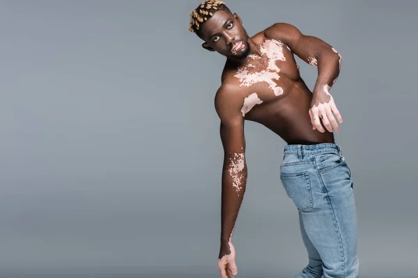 Молодий афроамериканський чоловік зі шкірою вітіліго, м'язистим торсом і модною зачіскою позує ізольовано на сірому — стокове фото