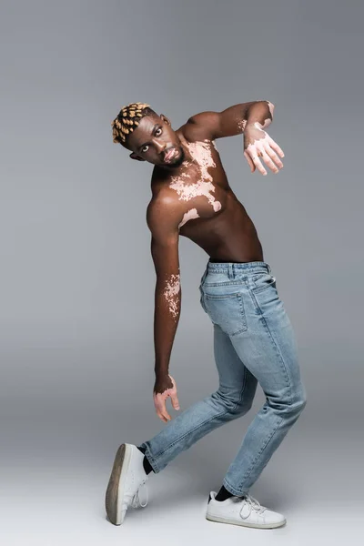 Full length view of african american man with vitiligo and shirtless torso posing in jeans isolated on grey — Fotografia de Stock