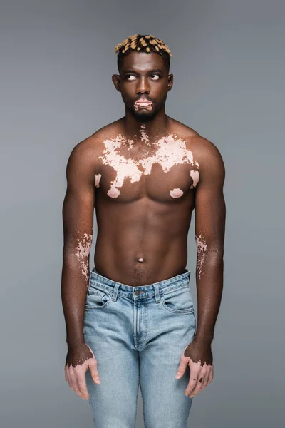 Shirtless african american man with vitiligo and stylish hairstyle looking aside isolated on grey — Photo de stock