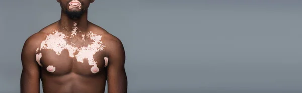 Cropped view of shirtless african american man with vitiligo skin and muscular torso  isolated on grey, banner — Stock Photo