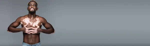 Shirtless african american man with vitiligo skin and muscular torso posing with hands on chest isolated on grey, banner — Stock Photo