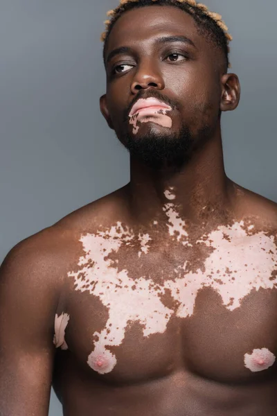 Young and shirtless african american man with vitiligo skin looking away isolated on grey — Foto stock