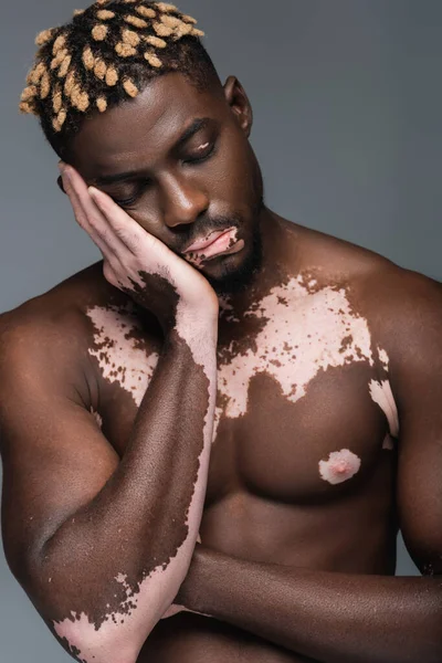 Tired african american man with vitiligo and muscular torso posing with closed eyes and hand near face isolated on grey — Foto stock