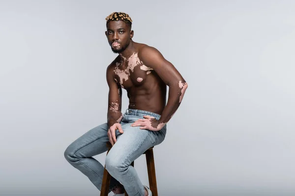 Young and shirtless african american man with vitiligo sitting on high stool and looking at camera on grey — Foto stock