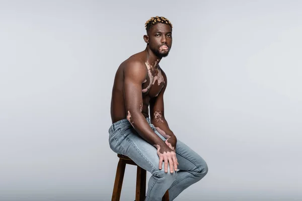 Hombre afroamericano sin camisa con vitiligo mirando a la cámara mientras está sentado en el taburete en jeans aislados en gris - foto de stock