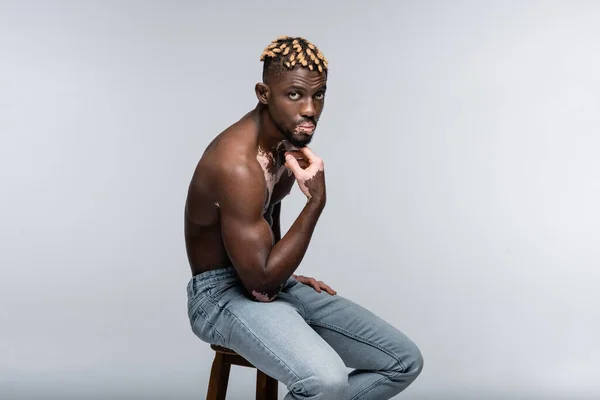 Young african american man with vitiligo skin touching chin while looking at camera on high stool isolated on grey — Stockfoto