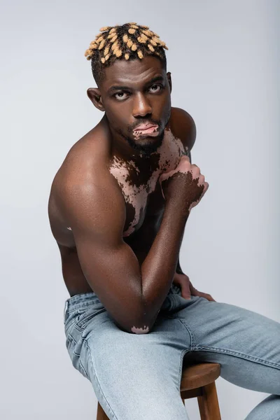 Young and muscular african american man with vitiligo skin looking at camera isolated on grey — Stock Photo