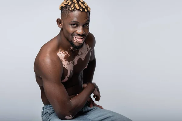 Shirtless african american man with vitiligo skin and muscular torso smiling at camera isolated on grey — Stockfoto