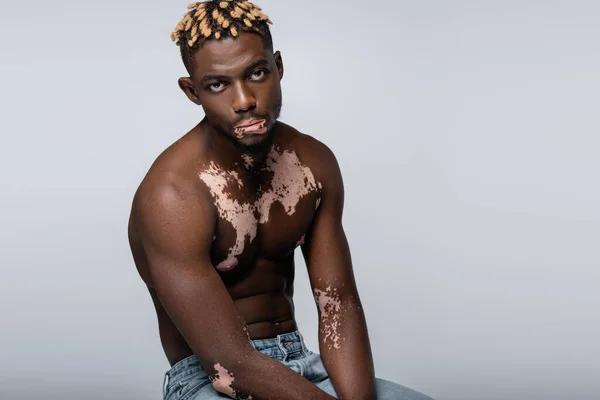 Shirtless african american man with vitiligo skin and muscular torso looking at camera while sitting isolated on grey - foto de stock