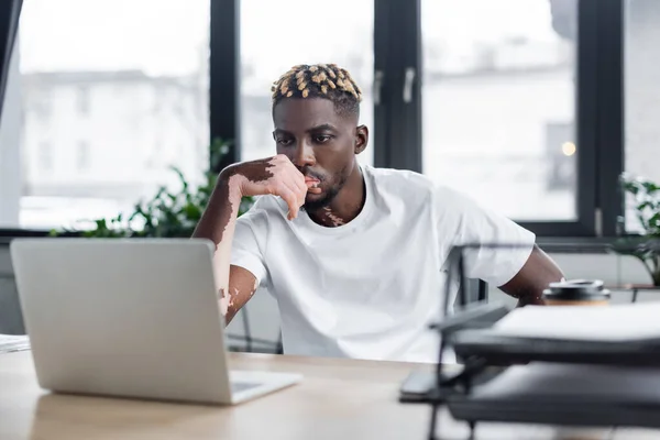 Serious african american man with vitiligo thinking near blurred laptop in office - foto de stock