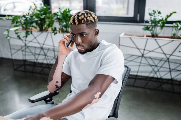 Молодий афроамериканський чоловік з вітіліго і модною зачіскою розмовляє на смартфоні в офісі — стокове фото
