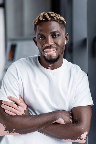 Smiling african american man with vitiligo skin standing with crossed arms and earphone in office — Stock Photo