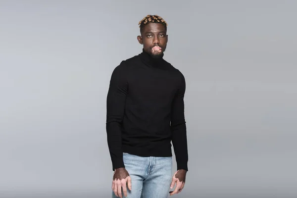 Trendy african american man with vitiligo posing in black turtleneck and jeans isolated on grey - foto de stock