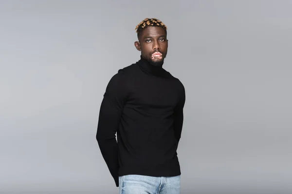 Stylish african american man with vitiligo posing with hands behind back isolated on grey — Foto stock