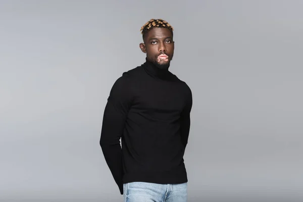 Stylish african american man with vitiligo posing with hands behind back isolated on grey — Fotografia de Stock