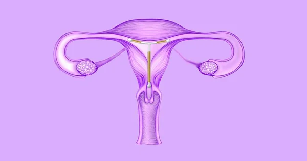 The female reproductive system with an intrauterine device inside. 3d illustration of female organs in very Peri color