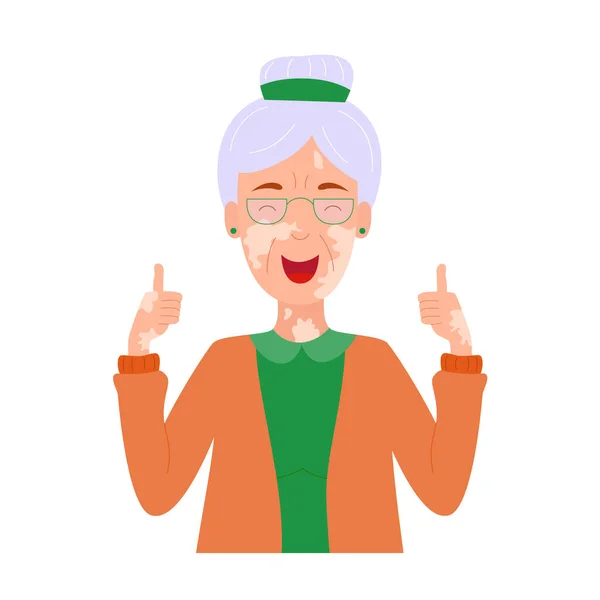 Vitiligo 'lu mutlu yaşlı bayan. Büyük anne baş parmağını kaldırıyor. Dünya Vitiligo Günü. Her yaşta güzellik ve kendini kabul etme kavramı. Deri hastalığı. Düz vektör illüstrasyonu.