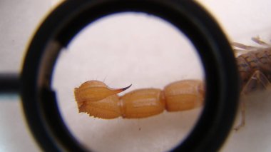 Yakın plan akrep iğnesi. Akrep iğnelerinin biyomekanik, anatomik ve fizyolojik özelliklerini inceleyin. Biyolog, egzotik veteriner sarı bir akrebi, vahşi yaşam veterinerini muayene ediyor. iğneli böcekler