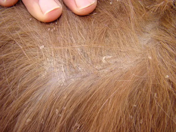 Flocos Caspa Veterinário Fazenda Examina Pele Cabra Com Caspa Medicina — Fotografia de Stock