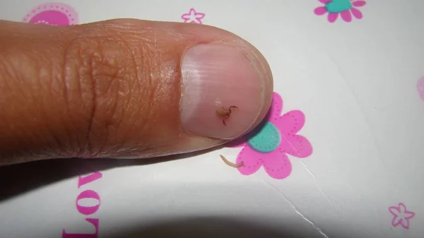 Pseudoscorpion. Tırnağındaki sahte akrebin boyutuyla tırnağın yakınındaki kurtçuk larvasını karşılaştırın. Biyolog, egzotik gazi elinde sahte bir akrep, vahşi yaşam veterineri