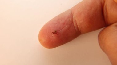 Pseudoscorpion. Parmağın ucundaki sahte akrep boyutu karşılaştırması. Biyolog, egzotik veteriner sahte akrep tutuyor, vahşi yaşam veterineri. Eklembacaklılar, omurgasızlar. böcek, böcek, hayvan, vahşi doğa