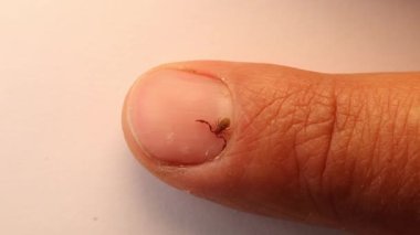 Pseudoscorpion. Tırnağındaki sahte akrep boyutu karşılaştırması. Biyolog, egzotik veteriner sahte bir akrep tutuyor, vahşi yaşam veterineri. Eklembacaklılar, omurgasızlar. böcek, böcek, hayvan, vahşi doğa