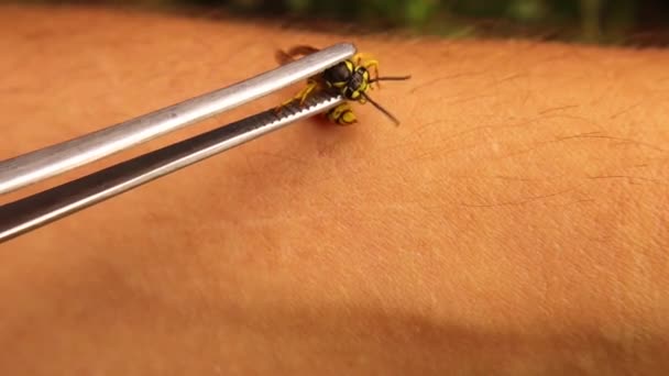 异国兽医让他的胳膊被一只黄色的黄蜂叮了一下 2分钟后 就会出现肿胀 这刺痛得很厉害 人们注意到 黄蜂可以在不伤害自己的情况下拔出刺刺 — 图库视频影像