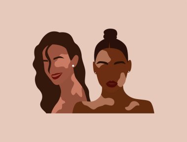 Farklı milletlerden iki kadın birlikte. Soyut, çehresiz, dişi. Pigmentasyon dermatoloji hastalığı konsepti. Modern düz vektör illüstrasyonu